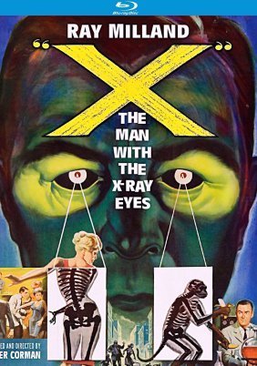 X: The Man with the X-Ray Eyes (1963)